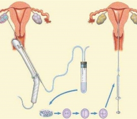 35岁女性备孕请做好以下检查，“健康郑州代生宝宝”跑不远